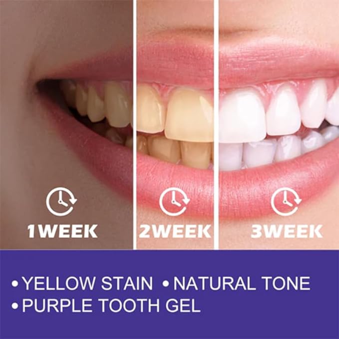 Purple Toothpaste – Instant Whitening Corrector